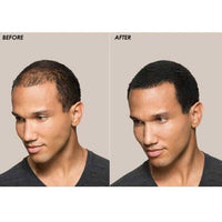 XFusion Keratin Hair Fibers XFusion by Toppik Shop at Skin Type Solutions